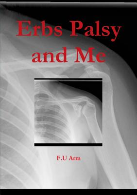 Erbs Palsy and Me