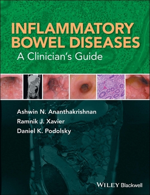 Inflammatory Bowel Diseases: A Clinician's Guide
