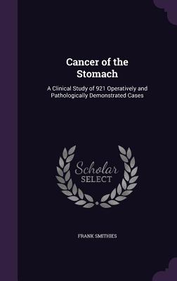 Cancer of the Stomach: A Clinical Study of 921 Operatively and Pathologically Demonstrated Cases