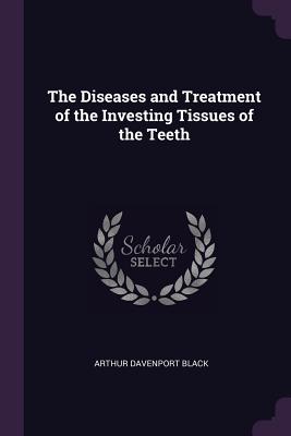 The Diseases and Treatment of the Investing Tissues of the Teeth