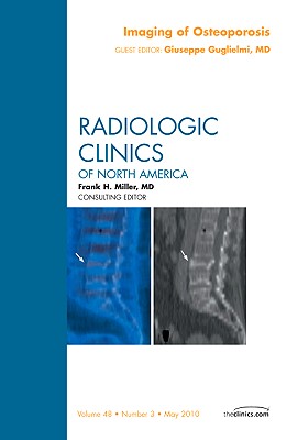 Imaging of Osteoporosis, an Issue of Radiologic Clinics of North America: Volume 48-3