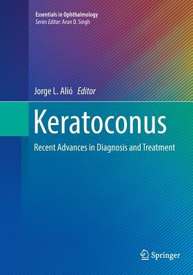 Keratoconus: Recent Advances in Diagnosis and Treatment