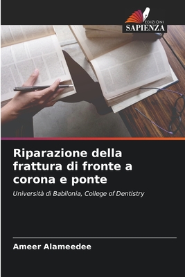 Riparazione della frattura di fronte a corona e ponte