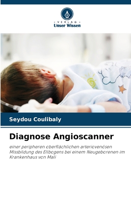 Diagnose Angioscanner