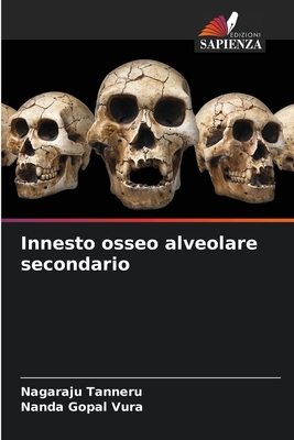Innesto osseo alveolare secondario