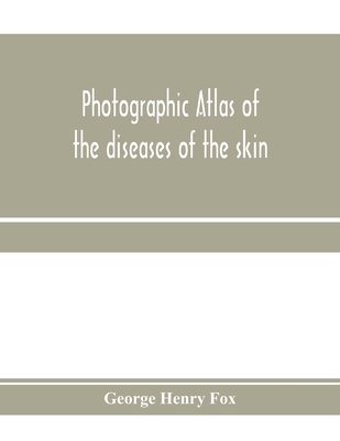 Photographic atlas of the diseases of the skin; A Series of Eighty Plates, Comprising more than One Hundred Illustrations, with Descriptive text, and