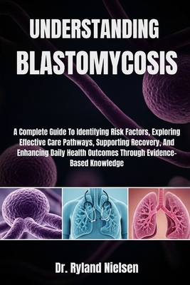 Understanding Blastomycosis: A Complete Guide To Identifying Risk Factors, Exploring Effective Care Pathways, Supporting Recovery, And Enhancing Daily