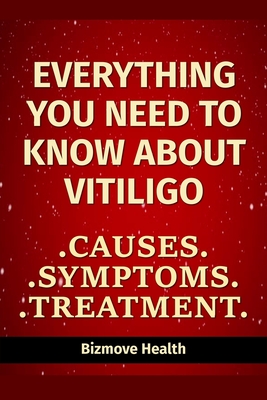 Everything you need to know about Vitiligo: Causes, Symptoms, Treatment