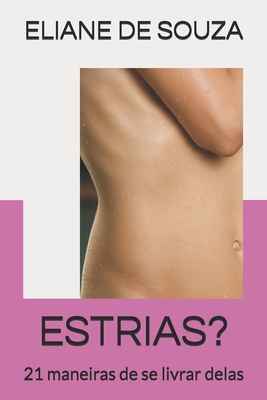 Estrias?: 21 maneiras de se livrar delas