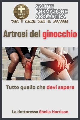 Artrosi del ginocchio: tutto quello che devi sapere: Sintomi, cause, diagnosi, trattamento, farmaci, prevenzione, controllo e gestione