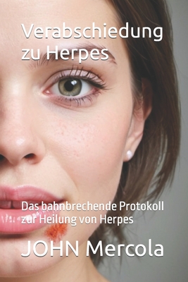 Verabschiedung zu Herpes: Das bahnbrechende Protokoll zur Heilung von Herpes